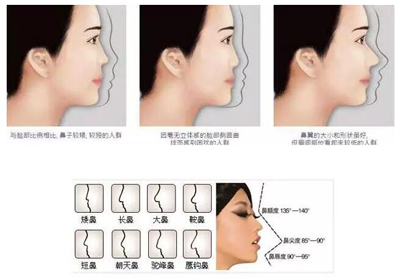 自体脂肪隆鼻是什么原理_自体脂肪隆鼻(3)